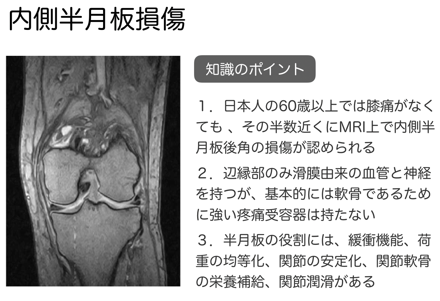 4 半月板損傷